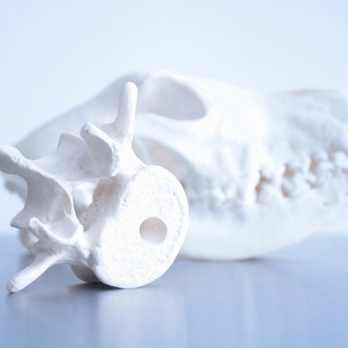 Knochen-und-Gelenkschirurgie-600x600